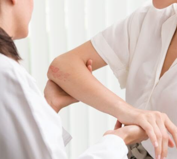 Skin Disorders